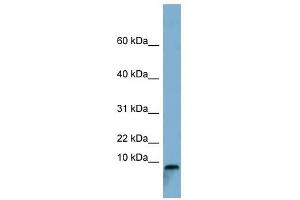 TCTA antibody used at 1 ug/ml to detect target protein.
