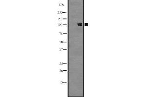 Western blot analysis of PKN3 expression in Hela cell lysate,The lane on the left is treated with the antigen-specific peptide. (PKN3 Antikörper  (Internal Region))