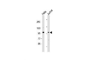 Western Blot at 1:1000 dilution Lane 1: Hela whole cell lysate Lane 2: Jurkat whole cell lysate Lysates/proteins at 20 ug per lane. (NSUN2 Antikörper  (AA 423-451))