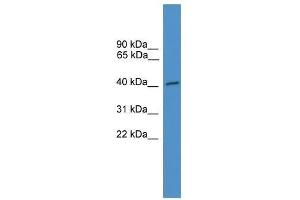 Western Blot showing NXF5 antibody used at a concentration of 1-2 ug/ml to detect its target protein. (NXF5 Antikörper  (C-Term))