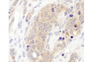 Immunohistochemistry (IHC) image for anti-Chaperonin Containing TCP1, Subunit 3 (Gamma) (CCT3) (AA 495-545) antibody (ABIN7453615) (CCT3 Antikörper  (AA 495-545))
