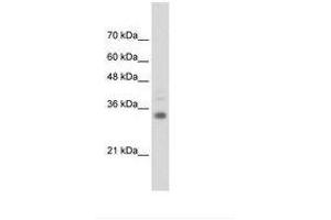 Image no. 1 for anti-Homeobox B4 (HOXB4) (C-Term) antibody (ABIN6736307)