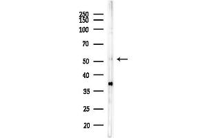 Western blot analysis of lysates from MDA-MB-231 cells(heat-shock,45 min treatment), using PFKF Antibody at 1/1000 dilution.