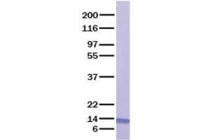 Validation with Western Blot (CXCL13 Protein)