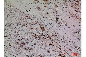 Immunohistochemistry (IHC) analysis of paraffin-embedded Human Brain, antibody was diluted at 1:100. (HDC Antikörper  (Internal Region))