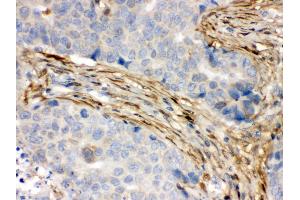 Immunohistochemistry (IHC) image for anti-S100 Calcium Binding Protein A6 (S100A6) (AA 1-90) antibody (ABIN3043320)