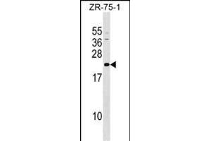GRPEL1 Antibody (Center) (ABIN1537772 and ABIN2849483) western blot analysis in ZR-75-1 cell line lysates (35 μg/lane). (GRPEL1 Antikörper  (AA 116-142))