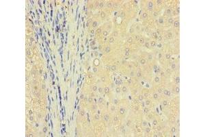 Immunohistochemistry of paraffin-embedded human liver tissue using ABIN7172006 at dilution of 1:100 (TXNDC8 Antikörper  (AA 1-115))