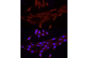 Immunofluorescence (IF) image for anti-Piezo-Type Mechanosensitive Ion Channel Component 1 (PIEZO1) (AA 2230-2420) antibody (ABIN6145612)