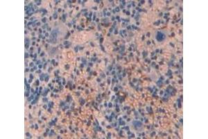 Used in DAB staining on fromalin fixed paraffin- embedded spleen tissue (TPM3 Antikörper  (AA 6-248))