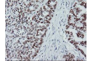 Image no. 2 for anti-Tumor Protein P53 (TP53) antibody (ABIN1499973) (p53 Antikörper)