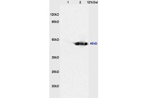 Lane 1: mouse heart lysates Lane 2: mouse kidney lysates probed with Anti CKIP-1 Polyclonal Antibody, Unconjugated (ABIN675039) at 1:200 in 4 °C. (PLEKHO1 Antikörper  (AA 51-170))