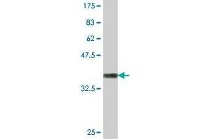 Western Blot detection against Immunogen (37 KDa) . (14-3-3 eta Antikörper  (AA 71-170))
