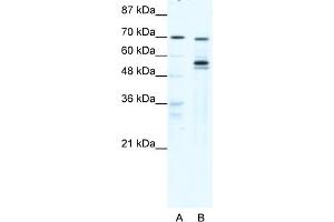 WB Suggested Anti-DDX55 Antibody Titration:  0. (DDX55 Antikörper  (N-Term))
