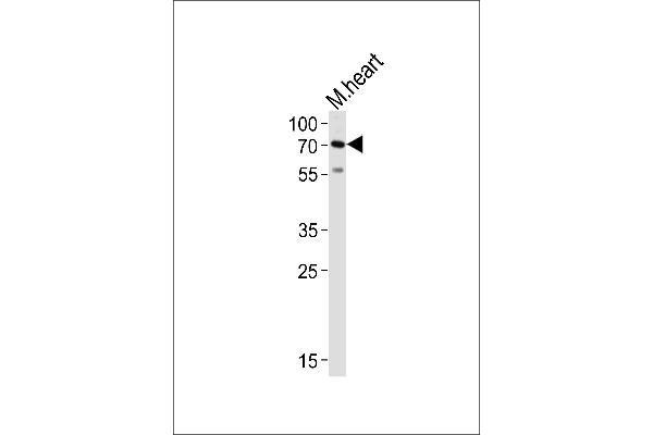 HAS2 Antikörper  (AA 138-166)