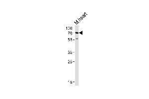 Western blot analysis of lysate from mouse heart tissue lysate, using HAS2 Antibody (Center) (ABIN651874 and ABIN2840432). (HAS2 Antikörper  (AA 138-166))