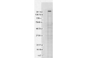 Western Blot analysis of Human Cell lysates showing detection of TrpM7 protein using Mouse Anti-TrpM7 Monoclonal Antibody, Clone S74-25 . (TRPM7 Antikörper  (AA 1817-1863) (PE))