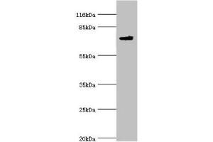 Western blot All lanes: MTMR7 antibody at 2 μg/mL + Mouse brain tissue Secondary Goat polyclonal to rabbit IgG at 1/10000 dilution Predicted band size: 76, 65 kDa Observed band size: 76 kDa (MTMR7 Antikörper  (AA 1-660))