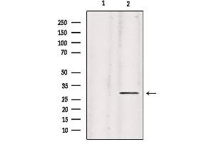 Western blot analysis of extracts from hela, using Collagen IX α2 Antibody. (Collagen Type IX alpha 2 (COL9A2) Antikörper)