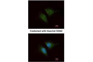ICC/IF Image Immunofluorescence analysis of methanol-fixed HeLa, using Coronin 1C, antibody at 1:200 dilution.