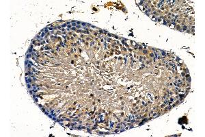 NCE2 Antibody at 1/100 staining mouse testis tissue by IHC-P. (UBE2F Antikörper)