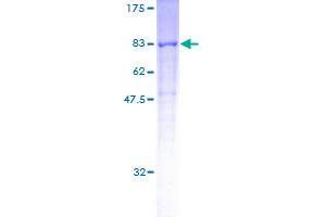 CORO2A Protein (AA 1-525) (GST tag)