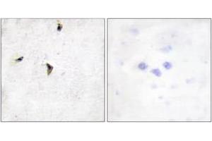 Immunohistochemistry analysis of paraffin-embedded human brain tissue, using Kv2. (Kv2.1/KCNB1 Antikörper  (AA 533-582))