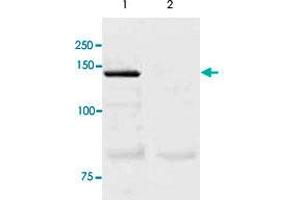 The tissue lysate derived from mouse lung was immunoprecipitated by NOS3 polyclonal antibody , then immuno-blotted by the same antibody at 1 : 500 (lane 1). (ENOS Antikörper  (C-Term))