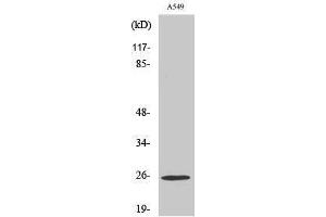 Western Blotting (WB) image for anti-rho GDP Dissociation Inhibitor (GDI) gamma (ARHGDIG) (Internal Region) antibody (ABIN3180861) (ARHGDIG Antikörper  (Internal Region))