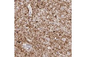 Immunohistochemical staining of human cerebral cortex with ZC3H7B polyclonal antibody  shows strong cytoplasmic positivity in glial cells at 1:50-1:200 dilution. (ZC3H7B Antikörper)
