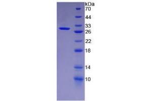 SDS-PAGE analysis of Human Keratin 18 Protein. (Cytokeratin 18 Protein)