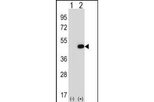 Western blot analysis of EIF2B3 (arrow) using rabbit polyclonal EIF2B3 Antibody (ABIN388637 and ABIN2838310). (EIF2B3 Antikörper  (C-Term))