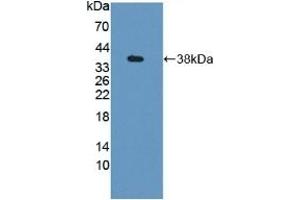 Detection of Recombinant GBP4, Mouse using Polyclonal Antibody to Guanylate Binding Protein 4 (GBP4) (GBP4 Antikörper  (AA 1-304))