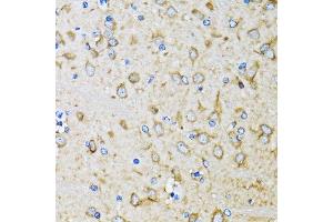 Immunohistochemistry of paraffin-embedded mouse brain using MAP1LC3B antibody. (LC3B Antikörper)