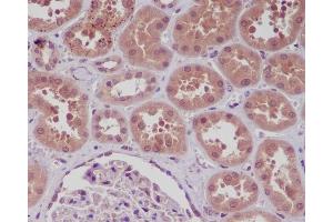 Immunohistochemistry (Paraffin-embedded Sections) (IHC (p)) image for anti-Nuclear Factor kappa B (NFkB) antibody (ABIN7606844)