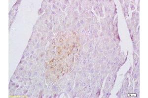 Immunohistochemistry (Paraffin-embedded Sections) (IHC (p)) image for anti-Sema Domain, Immunoglobulin Domain (Ig), Transmembrane Domain (TM) and Short Cytoplasmic Domain, (Semaphorin) 4C (SEMA4C) (AA 751-833) antibody (ABIN737991)