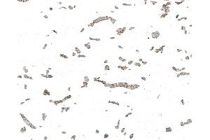 Immunocytochemistry (ICC) image for anti-Desmoglein 3 (DSG3) antibody (ABIN7795599) (Desmoglein 3 Antikörper)