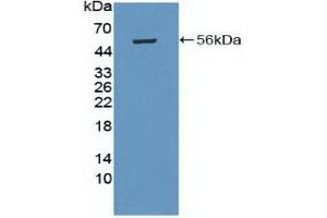 Detection of Recombinant PRKAb1, Human using Polyclonal Antibody to Protein Kinase, AMP Activated Beta 1 (PRKAb1) (PRKAB1 Antikörper  (AA 13-242))