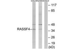 Western blot analysis of extracts from COLO/HuvEc cells, using RASSF4 Antibody. (RASSF4 Antikörper  (AA 134-183))