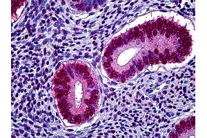 Anti-PGR / Progesterone Receptor antibody IHC of human uterus. (Progesterone Receptor Antikörper)
