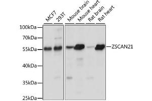 Western blot analysis of extracts of various cell lines, using ZSCAN21 antibody. (ZSCAN21 Antikörper)