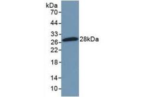 Detection of Recombinant NFkB2, Mouse using Polyclonal Antibody to Nuclear Factor Kappa B2 (NFkB2) (Nuclear Factor kappa B2 (AA 25-224) Antikörper)