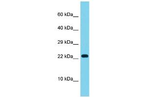 Host: Rabbit Target Name: ATP5S Sample Type: ACHN Whole cell lysates Antibody Dilution: 1.