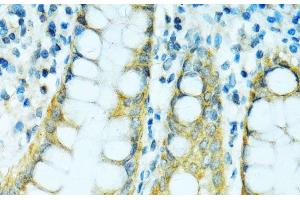 Immunohistochemistry of paraffin-embedded Human colon using CYP2B6 Polyclonal Antibody at dilution of 1:100 (40x lens). (CYP2B6 Antikörper)