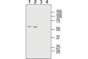 Western blot analysis of human HT-29 colon adenocarcinoma cell line lysate (lanes 1 and 3) and human ARPE-19 retinal pigment epithelium cell line lysate (lanes 2 and 4): - 1,2. (SLC16A1 Antikörper  (6th Extracellular Loop))