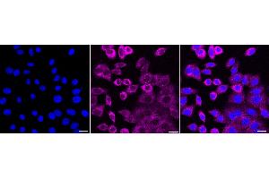 Immunocytochemical staining of HepG2 cells with Oxytocin receptor antibody (ABIN7799717), 1:1,000).