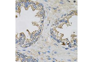 Immunohistochemistry of paraffin-embedded human prostate using EIF3H Antibody. (EIF3H Antikörper)