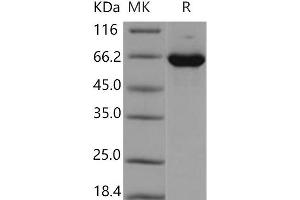 Western Blotting (WB) image for Mitogen-Activated Protein Kinase 1 (MAPK1) protein (GST tag,His tag) (ABIN7320277) (ERK2 Protein (GST tag,His tag))
