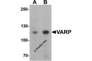 Western Blotting (WB) image for anti-Ankyrin Repeat Domain 27 (VPS9 Domain) (ANKRD27) (N-Term) antibody (ABIN1031656) (ANKRD27 Antikörper  (N-Term))
