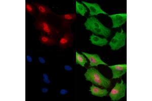 Phospho-Nanog (Thr280) Antibody staining A549 cells(H2O2 treatment) by IF/ICC.